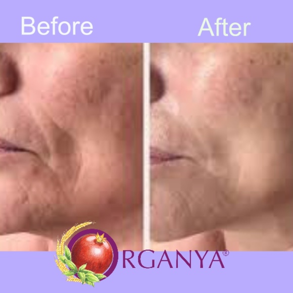 Retinol 18 Vitamin A Revolution Night Serum 30ml - Picture 5 of 14